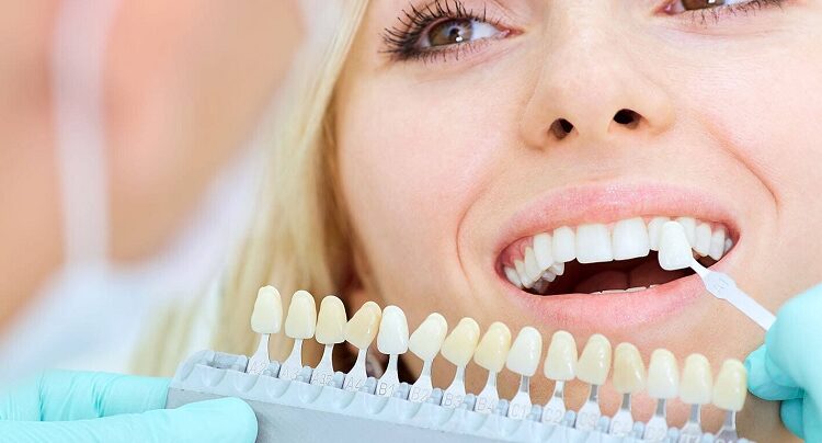 Cosmetic Dental Treatmentss